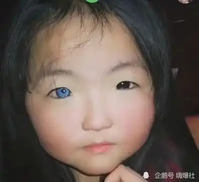 女孩天生异瞳走红,睁开眼那时,网友动漫萝莉

