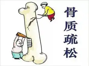 骨质疏松防治的常见误区第一个大部分人都会搞混
