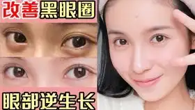 总以为黑眼圈就是熬夜熬出来的不一定看看你是哪种黑眼圈吧
