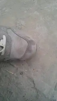 这种鞋子上的污迹特别是网纱上面的污迹怎么搞,大家知道吗
