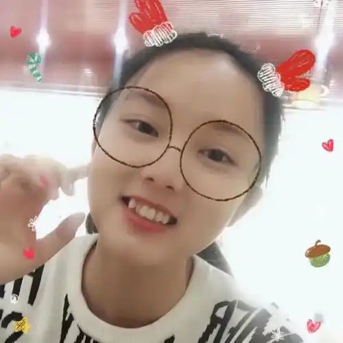 正畸分享牙套日记春风十里怎敌你笑靥如花
