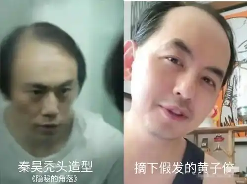 秃头人最后的倔强假发不被发现

