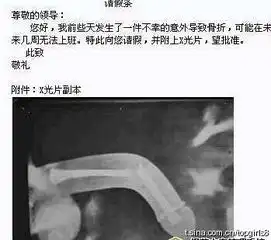 jj骨折怎么办
