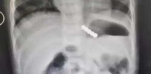 厦门家长注意这种网红玩具有毒你给孩子买了吗
