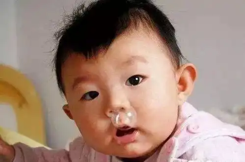 宝宝流鼻涕就是生病如何赶走鼻涕虫
