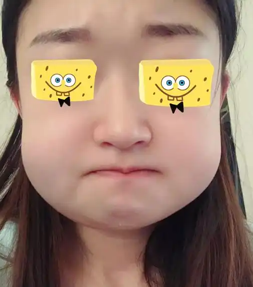 为啥医生不让一次性把智齿都拔了哈哈哈照片曝光,又心疼又好笑
