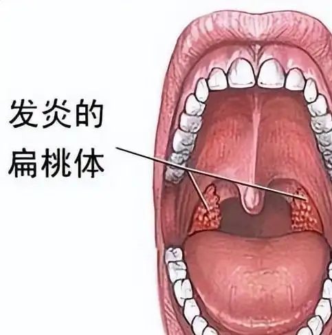 人体最没用的几个器官,割掉反而更好有的人早就没有了
