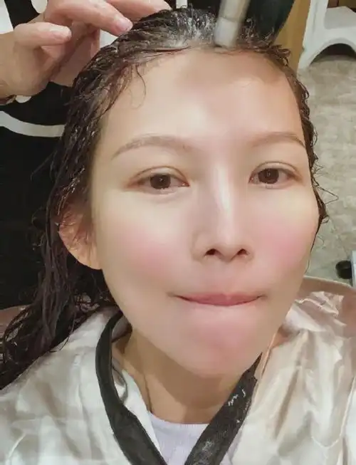 女明星断崖式衰老,董洁发际线光秃秃,胡杏儿产后脱发辛酸
