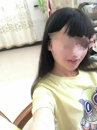 一个人拍的人脸照片两只眼被模糊了怎么还原
