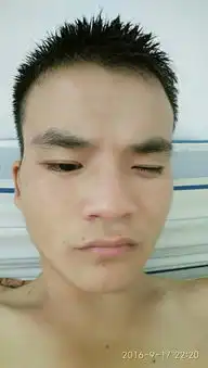 脸上有痣会不会影响相亲,相亲了要求见面该说些什么好
