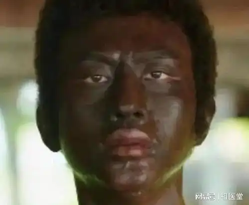 晒黑,其实是皮肤在自我保护祖医堂给您推荐的夏天防晒法
