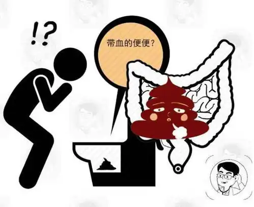 放屁多臭就是肠癌的表现告诫这3种情况,才真的要警惕起来
