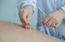 阴阳失衡容易胖经络减肥可调节
