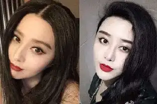 女子8年整容成范冰冰微整形前景广阔

