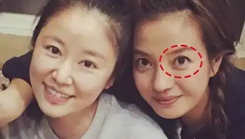 咖啡因能去除黑眼圈祸害大半个娱乐圈女星的熊猫眼有救了
