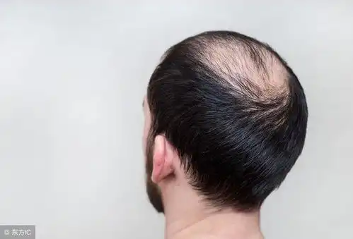 好男一身毛这四处毛多说明你健康
