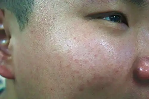 为何坚持跑步的人,看起来比别人显老了是哪里做错了吗
