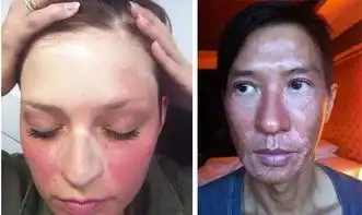 防晒做到什么程度,才能算得上360度无死角
