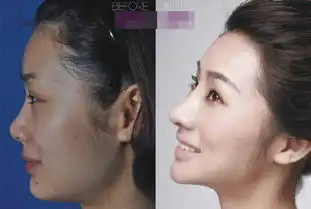 看看这些整容前后照片,就知道为何会有大把的人跑去整容
