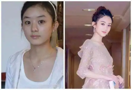 25位明星出道前后照片对比,没当明星前颜值还不如普通人
