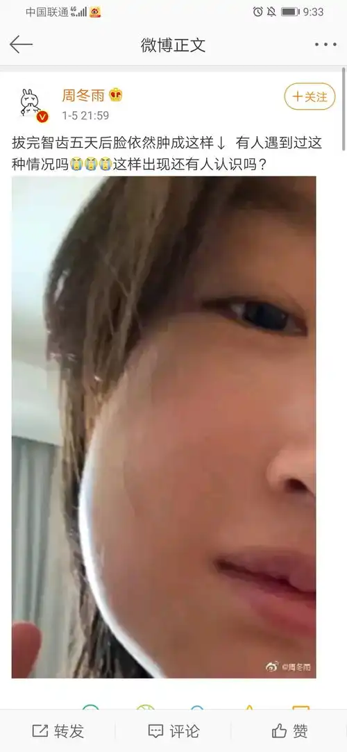 心疼又搞笑周冬雨戴口罩领奖小黄鸭撞脸被蜜蜂蛰了的狗狗
