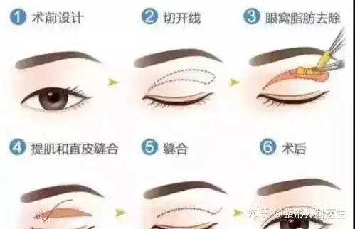 切开真的比埋线好看吗
