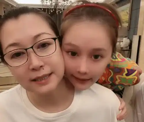 球球在无滤镜的情况下素颜直播,颜值被赞像赵本山戴了假发
