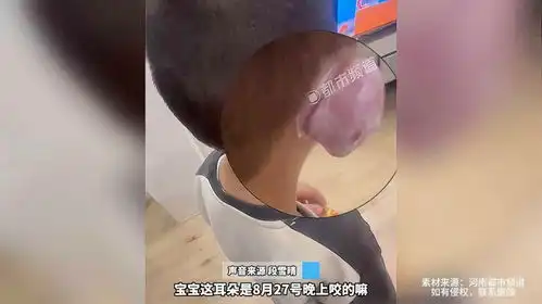 这不是大耳朵图图吗儿子耳朵被蚊子咬成柿饼
