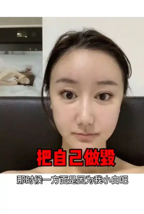 女网红花60万整容换脸,磨骨隆鼻险毁容后又多次整容,脸僵不自然
