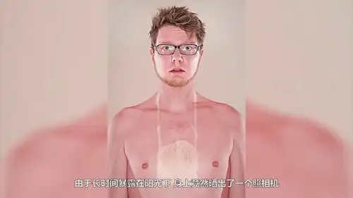 晒太阳晒的妈都不认识了,这老外也太作死了15个搞笑的晒黑图片

