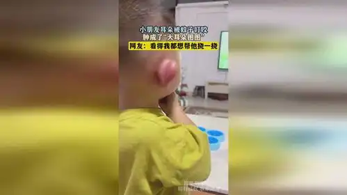 小朋友耳朵被蚊子叮咬,肿成了大耳朵图图,网友看得我都想帮他挠一挠
