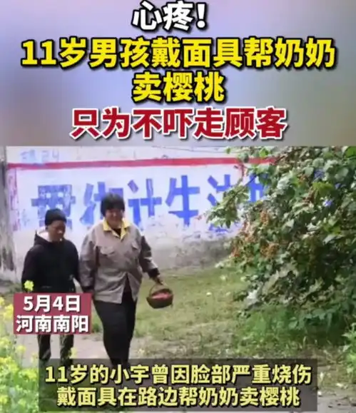 心疼11岁小男孩因脸部严重烧伤,戴面具帮奶奶卖樱桃,只为不吓走顾客
