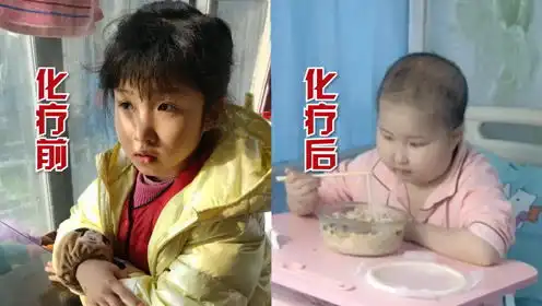 9岁女儿患上白血病,妈妈放出化疗前后对比图,巨大变化令人心痛
