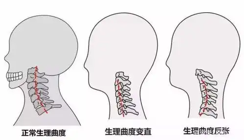 排排坐吊脖子脆皮年轻人为养生晒完背又开始搞事情
