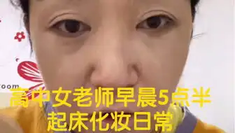 盘点那些搞笑被蜜蜂蛰过的搞笑场景吧
