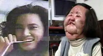美丑绝对论第四期那些整容失败丑的可方任何物,俗称辟邪
