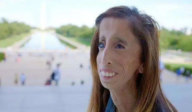 世界上最丑的女人,遭到帅哥疯狂追求,很多人追不到她感到遗憾
