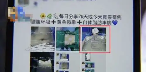 整容需谨慎女子做手术时被拍下全裸照片,院方将照片公布于网上
