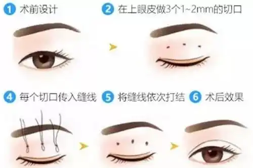 短发配大眼,不时尚都难
