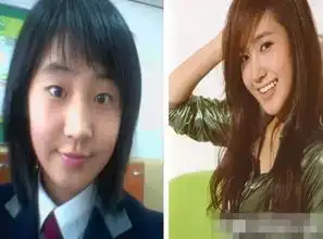 这样割双眼皮,没人敢说你的双眼皮好假

