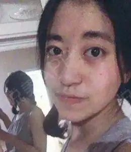 其实我脸上的痣不多的,才几颗,但是算命的师傅说有颗...去痣悦美整形
