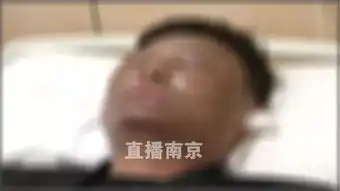 别买了厚街随处可见的网红气球爆炸了,整张脸都被炸黑...
