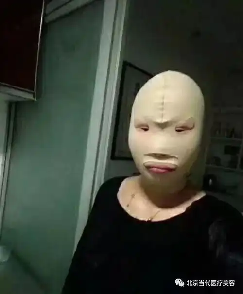 醉人的买家秀进军微整届你们真的不是来搞siao的
