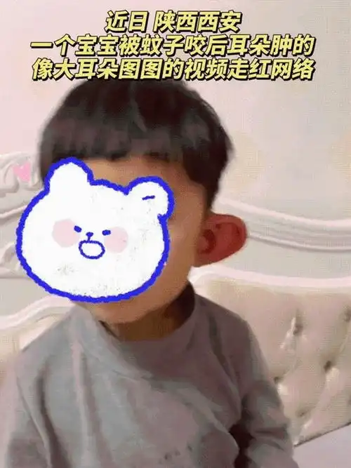 抖十商城,企业赋能萌娃耳朵被蚊子叮成大耳朵图图网友既心疼又想笑
