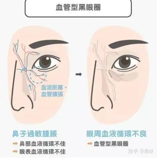 有哪些好用的眼霜能帮助经常熬夜的学生党工作党去除黑眼圈
