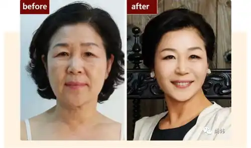 丑女的未来,不做微整,你永远也不知道原来自己还可以这么好看
