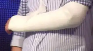 谁能给我几张手臂打石膏的照片
