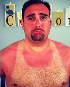 姑娘听说你又晒黑了还不懂怎么修复
