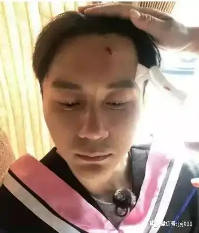 跑男背后的辛酸,李晨受伤不下十次,baby不敢做月子,陈赫.......
