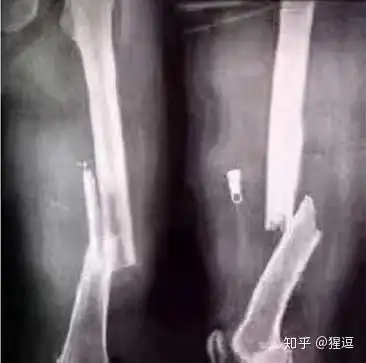 搞笑段子后悔拍大腿导致骨折,人类过年吃的表姐炖蘑菇

